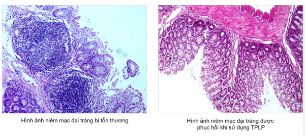 Nghiên cứu về Tràng Phục Linh Plus đăng trên PubMed - Thư viện Y học Quốc gia Hoa Kỳ 2 Nghiên cứu về Tràng Phục Linh Plus đăng trên PubMed - Thư viện Y học Quốc gia Hoa Kỳ 2